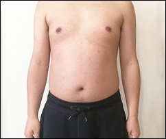 15-1day-body-front-view