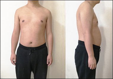 body-2017-03-05-front